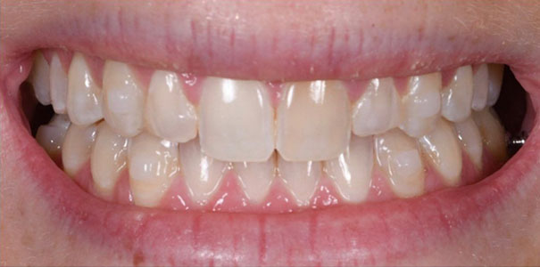 Before Image