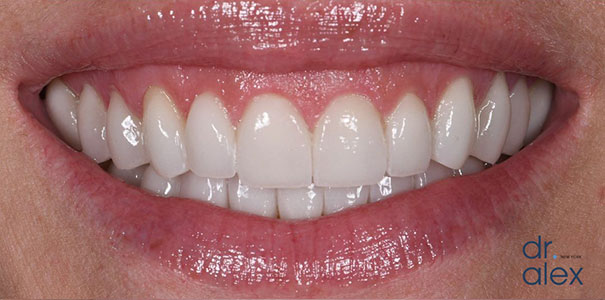 After Image
