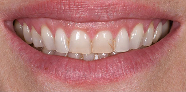 Before Image