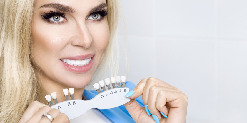 porcelain veneers
