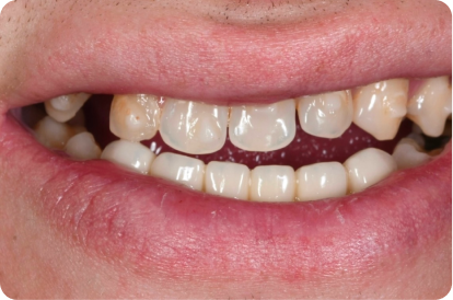James Gallagher Image Before