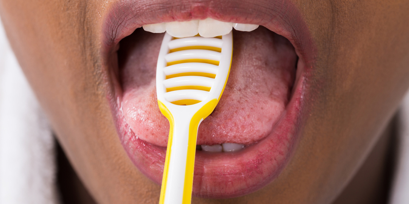 How To Prevent A White Coated Tongue