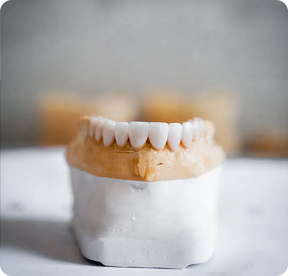 Why Get Porcelain Veneers
